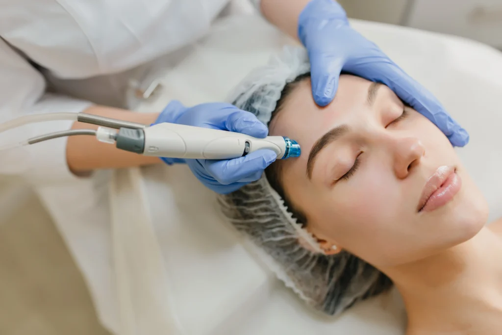 Laser Treatment for Face