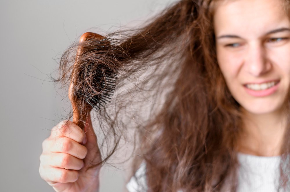 hairfall