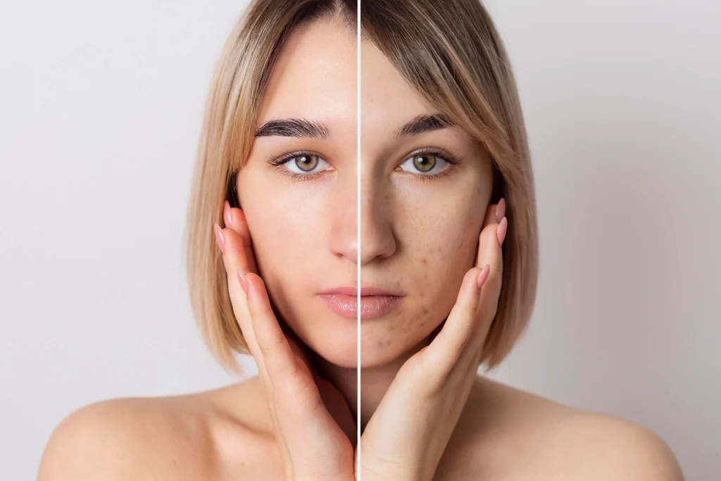 Pigmentation Meaning in Hindi