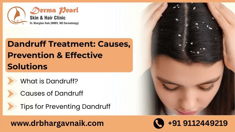 Dandruff Treatment for Healthy, Flake-Free Hair