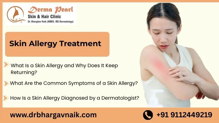 skin allergy treatment