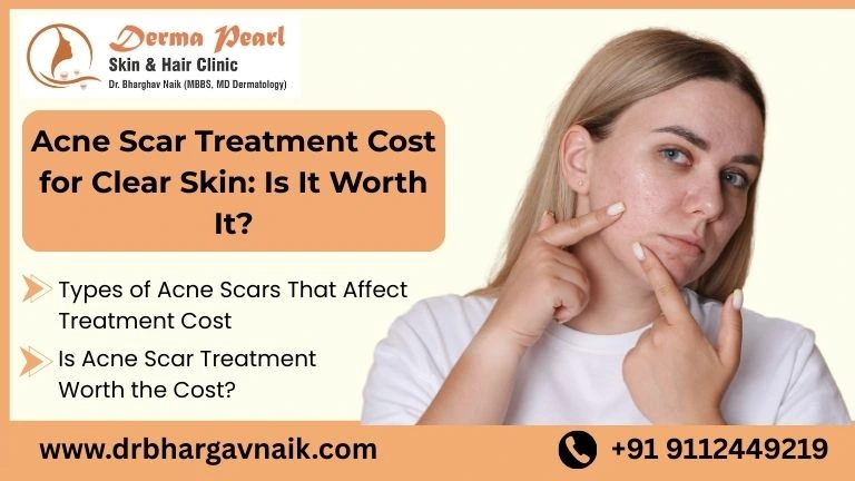 Acne Scar Treatment Cost