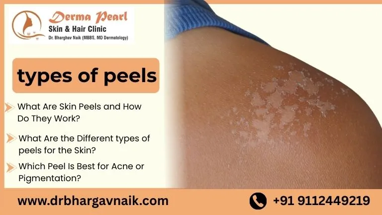 types of peels