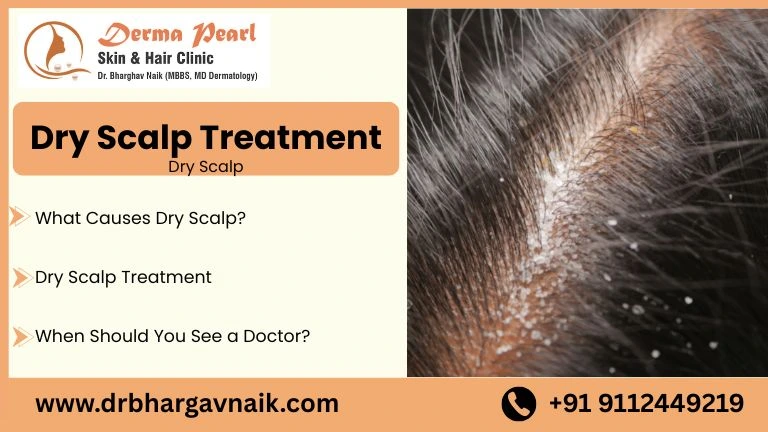 dry scalp treatment​
